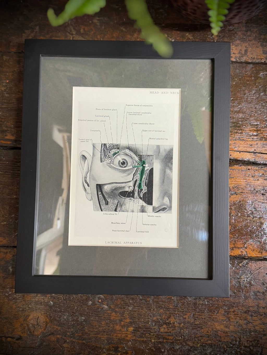 Framed Antique Anatomy Print 1920s Medical Book Plate Wall Art Picture C