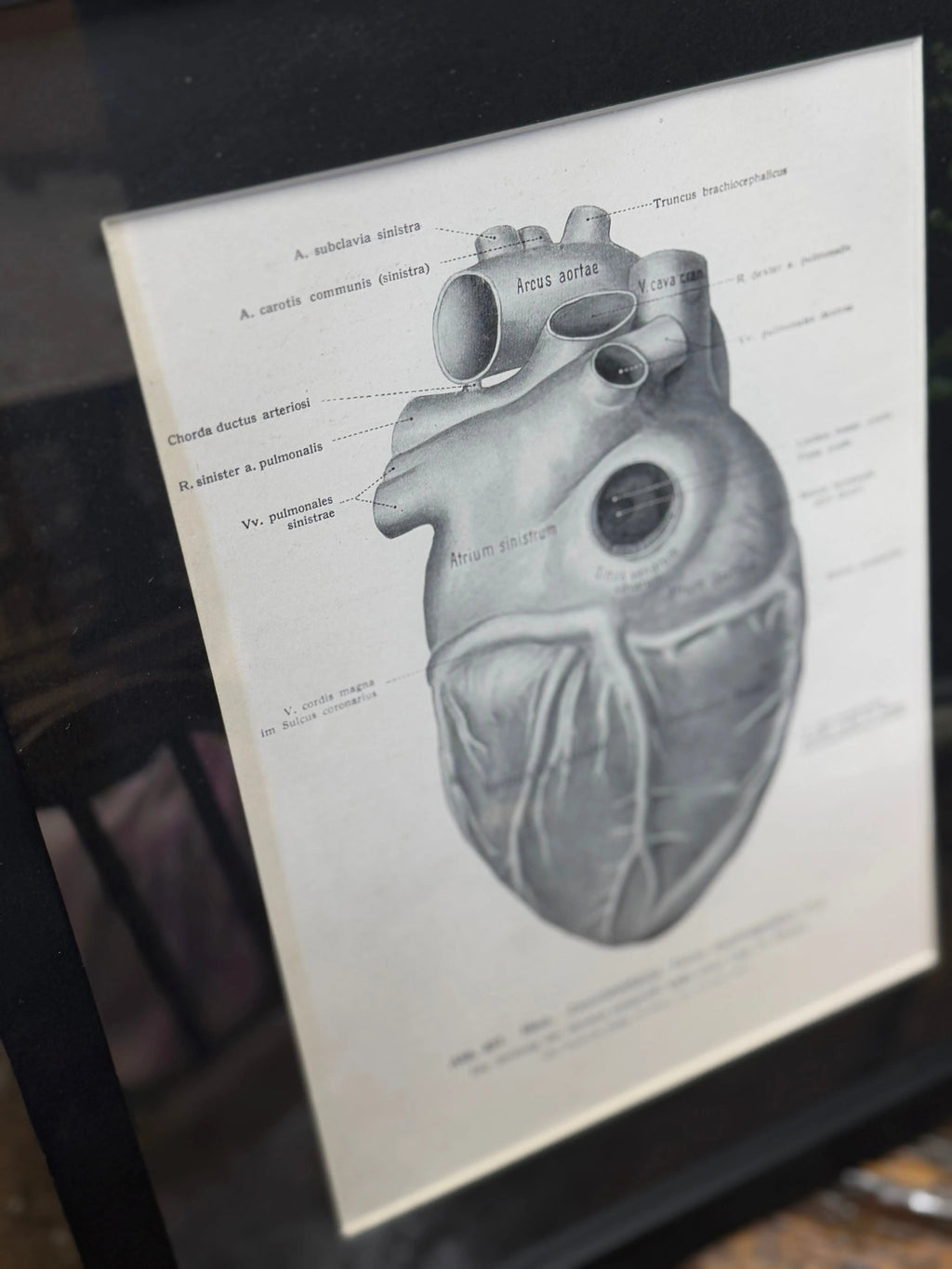 Framed Antique Anatomy Print 1920s Medical Book Plate Wall Art Picture T
