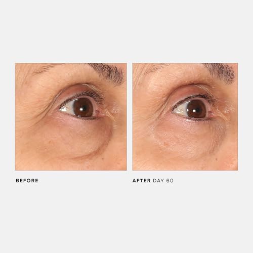 U Beauty The RETURN Eye Concentrate – Peptide Anti-Aging Cream, 0.5 fl oz
