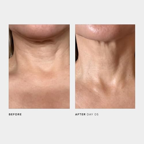 U Beauty The SCULPT Neck + Décolleté Concentrate - Firming Treatment