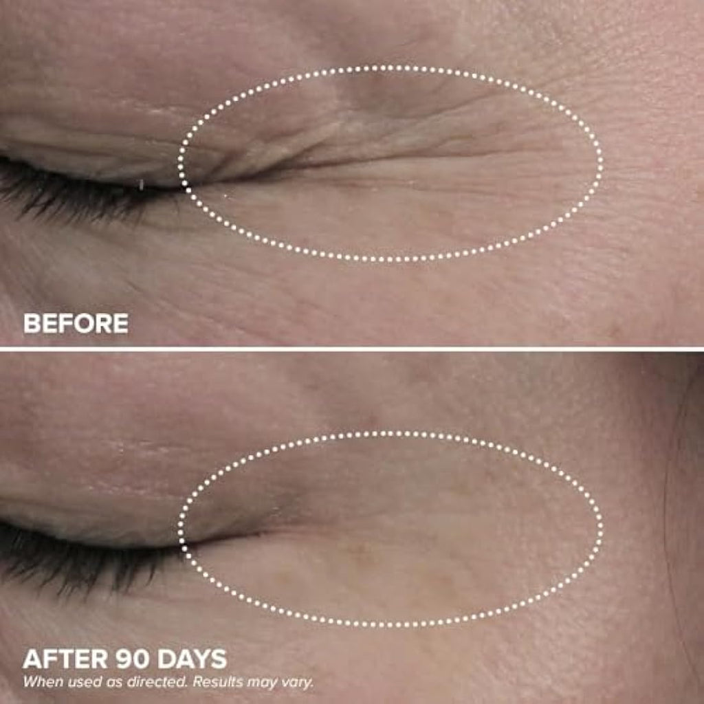 DRMTLGY HPR Retinoid Eye Cream – Anti-Aging Under Eye Treatment, 0.5oz
