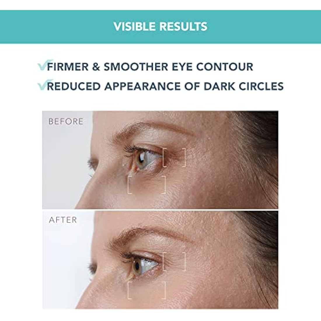 FOREO IRIS Firming Eye Serum – Retinol & Bakuchiol Treatment - 15ml