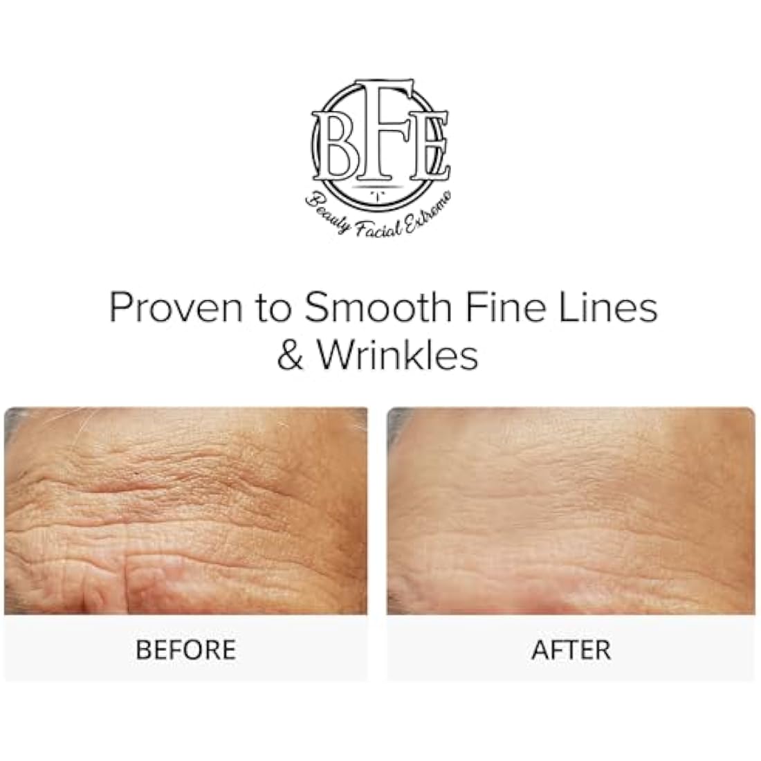 Glycolic Acid 15% Anti-Wrinkle Cream with Green Tea Extract