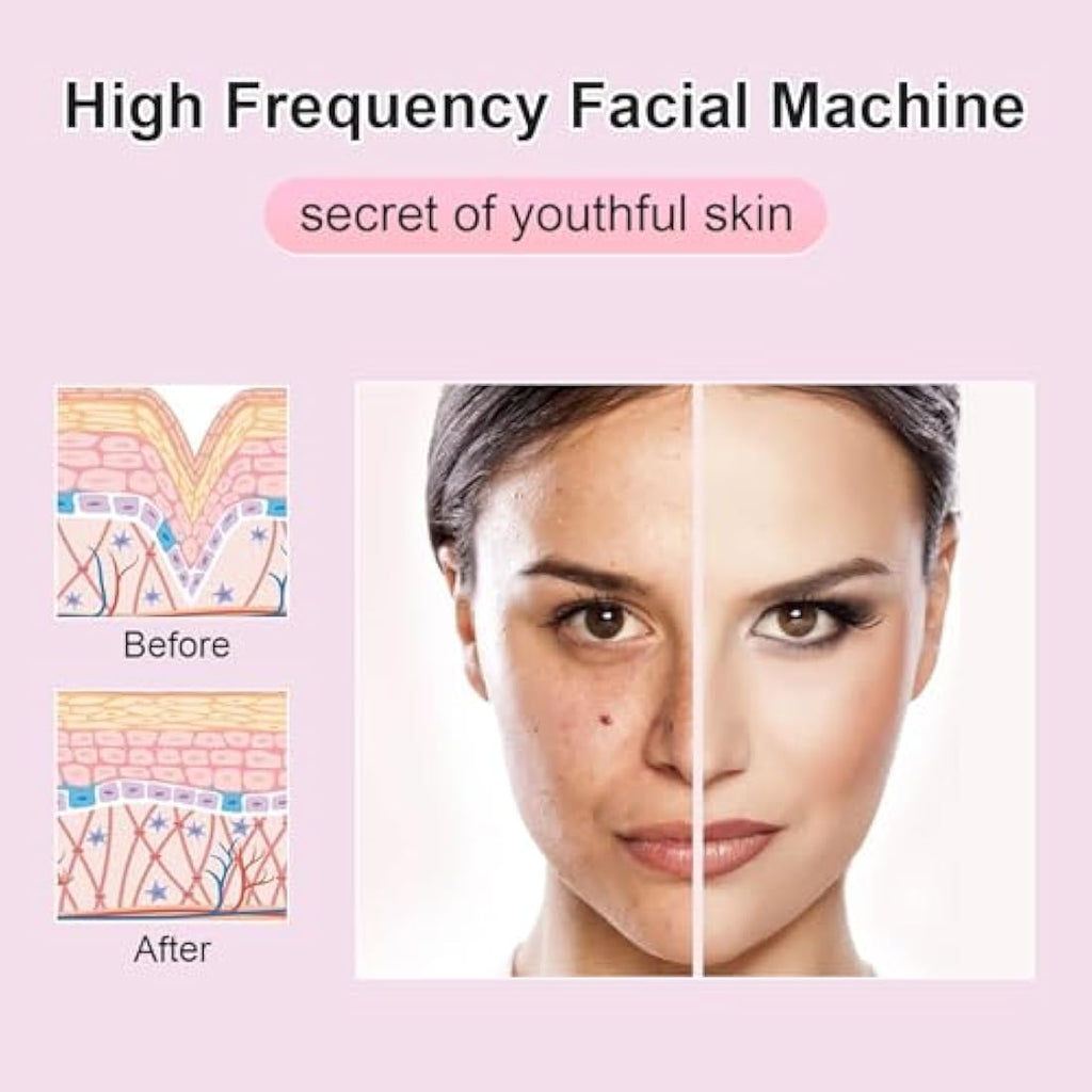 High Frequency Facial Wand – Portable Skin Tightening Machine