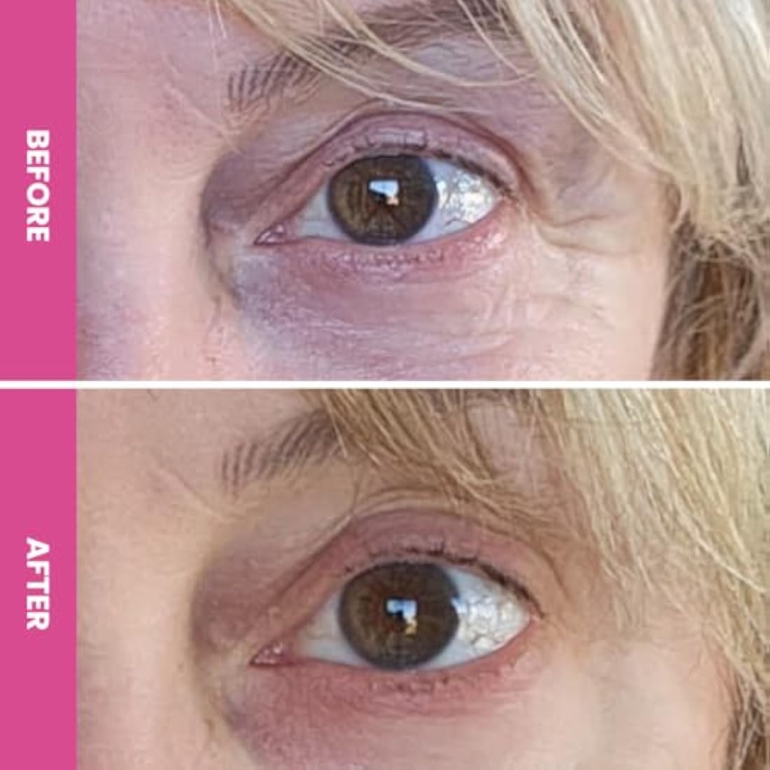 Prime Prometics PrimeEyes Hydrate Eye Cream for Dark Circles & Wrinkles