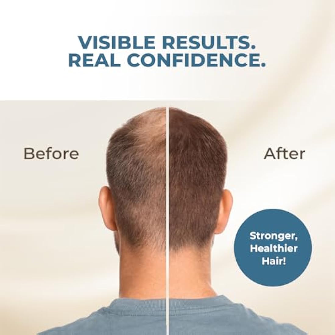 HAIRMETTO Saw Palmetto & Pumpkin Seed Oil Hair Growth Scalp Treatment