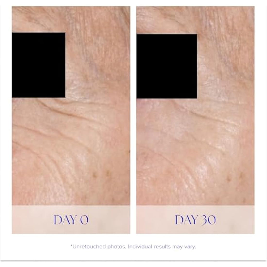 iS CLINICAL Youth Eye Complex – Anti-Aging Firming Peptide Eye Cream