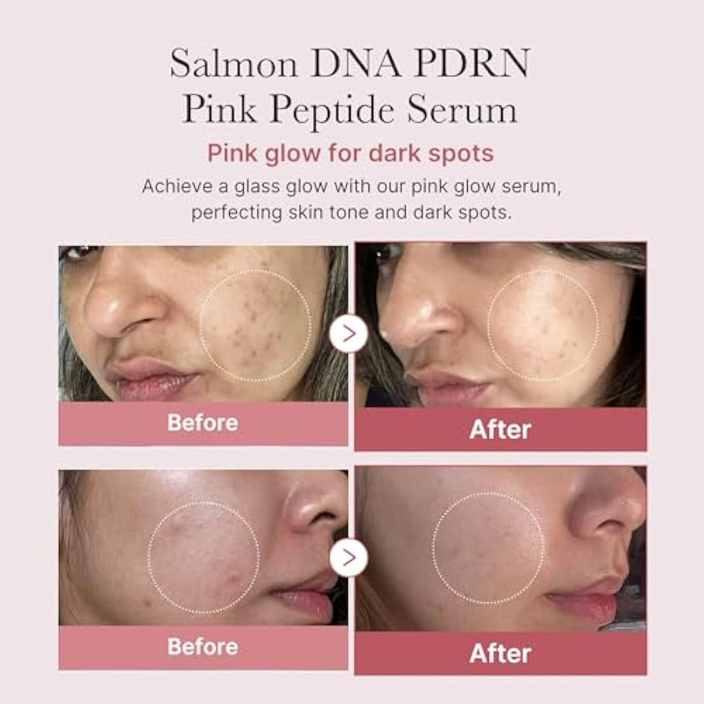 Medicube PDRN Pink Peptide Serum – Firming & Barrier Repair 30ml
