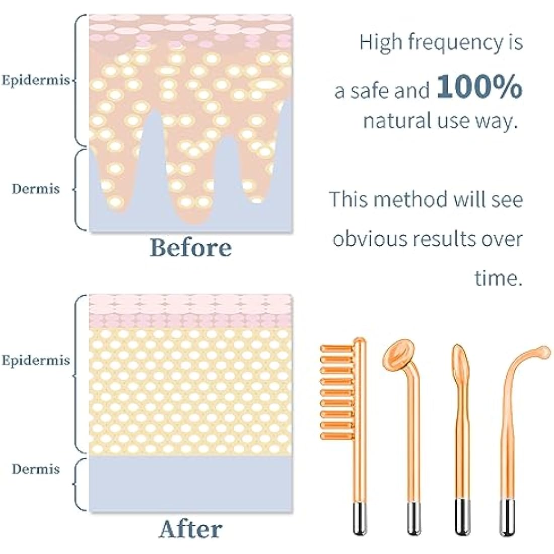 TUMAKOU High Frequency Facial Machine | Neon Skin Tightening Wand with 4 Tubes
