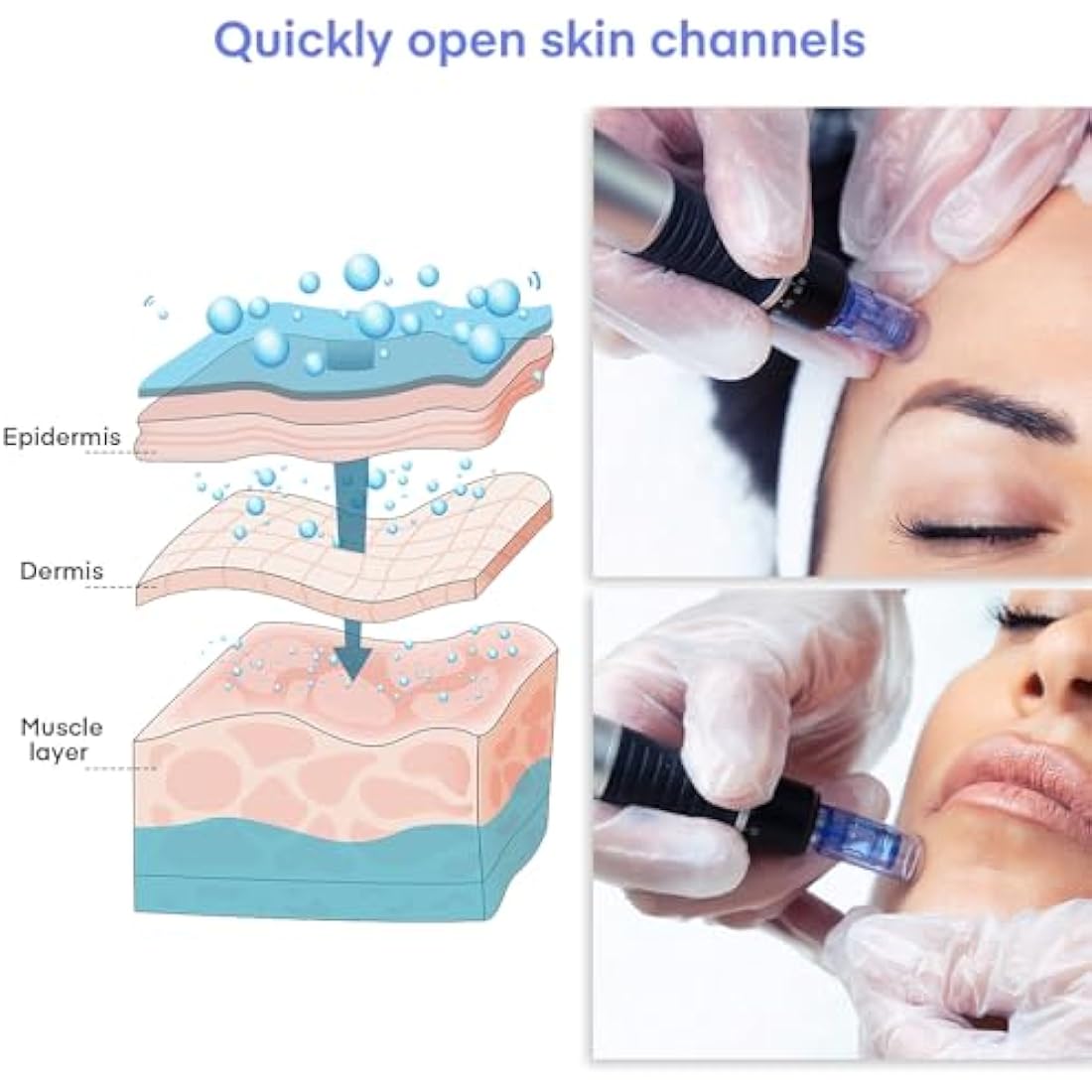 12-Pin Microneedling Cartridges for Ultima A6 - 20 Pack