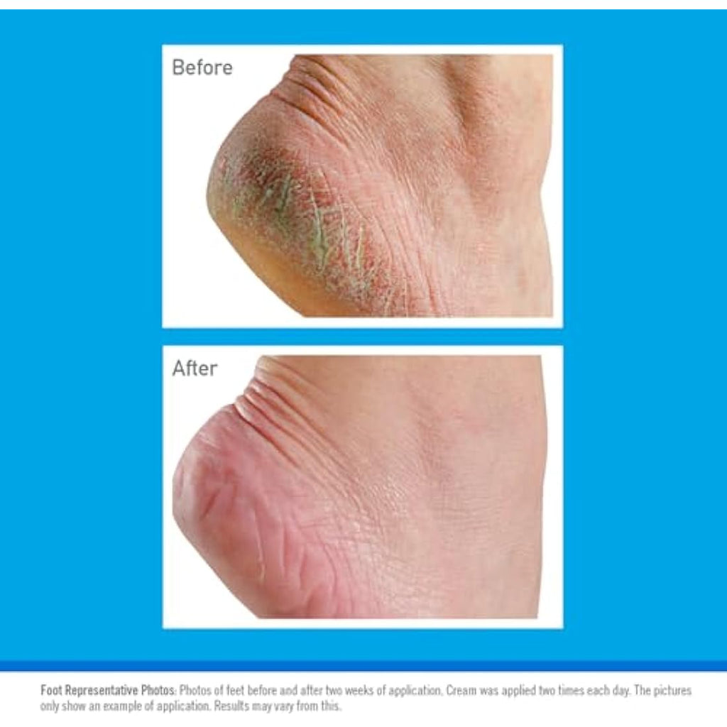 O'Keeffe's Healthy Feet Foot Cream for Dry Cracked Skin, 80ml (5 Pack)