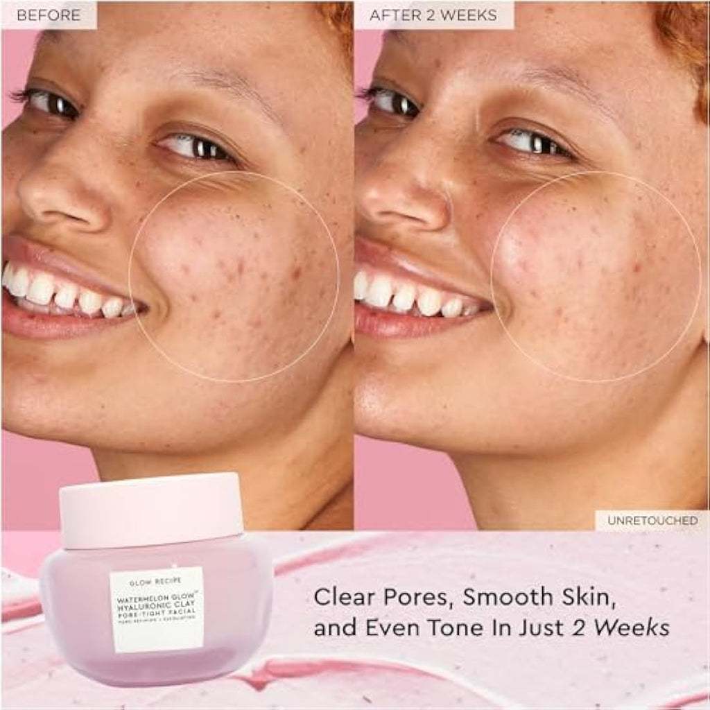 Glow Recipe Watermelon Glow Hyaluronic Clay Pore-Tight Facial - 60ml