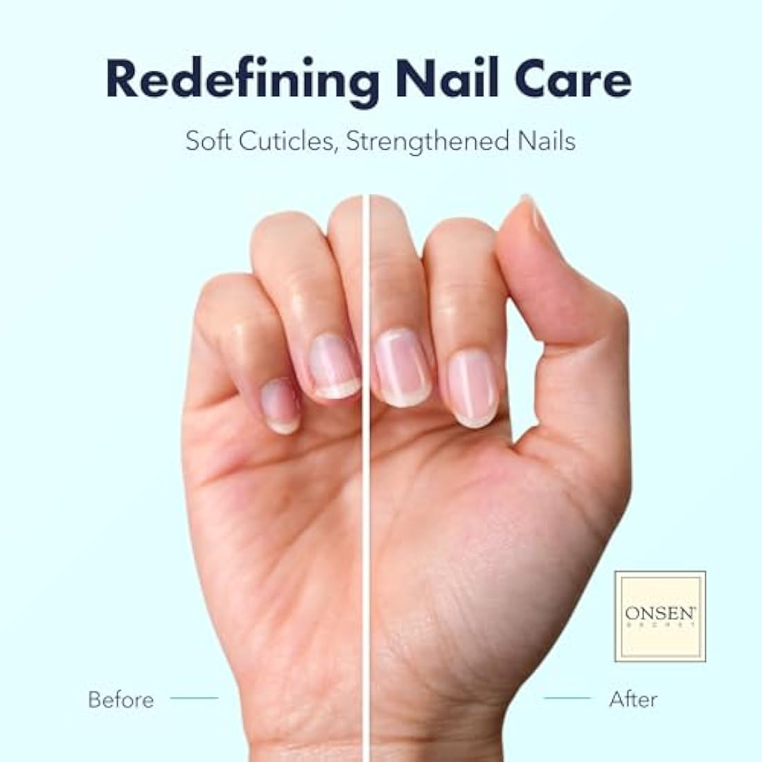 Onsen Organic Cuticle Oil – Tsubaki & Tea Tree Nail Strengthener (10ml)
