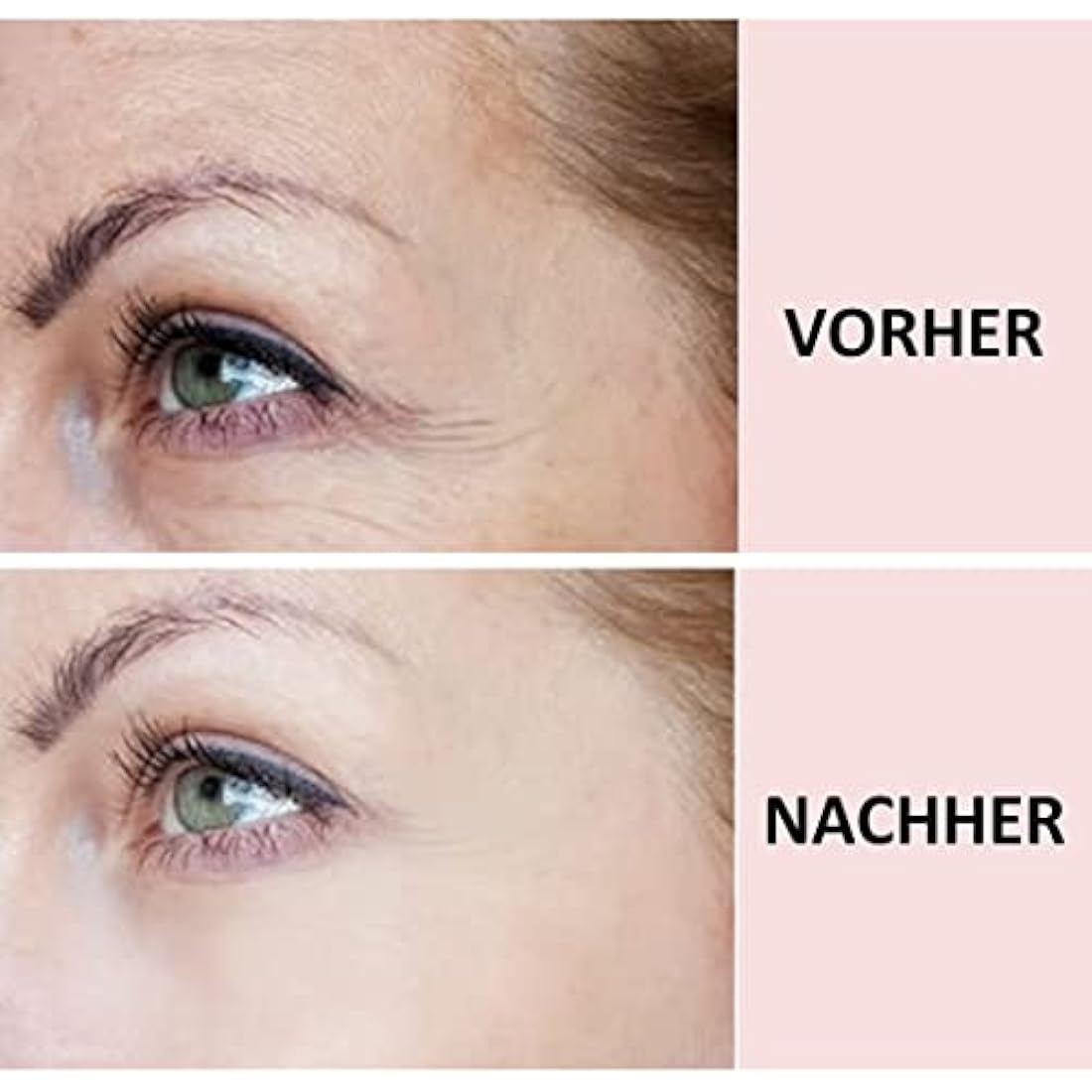 Sandy Skin 2-in-1 Reusable Forehead and Eye Wrinkle Pads