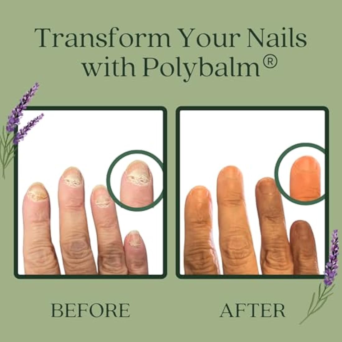 Polybalm Nail Health Treatment Balm | Natural Plant-Based Repair