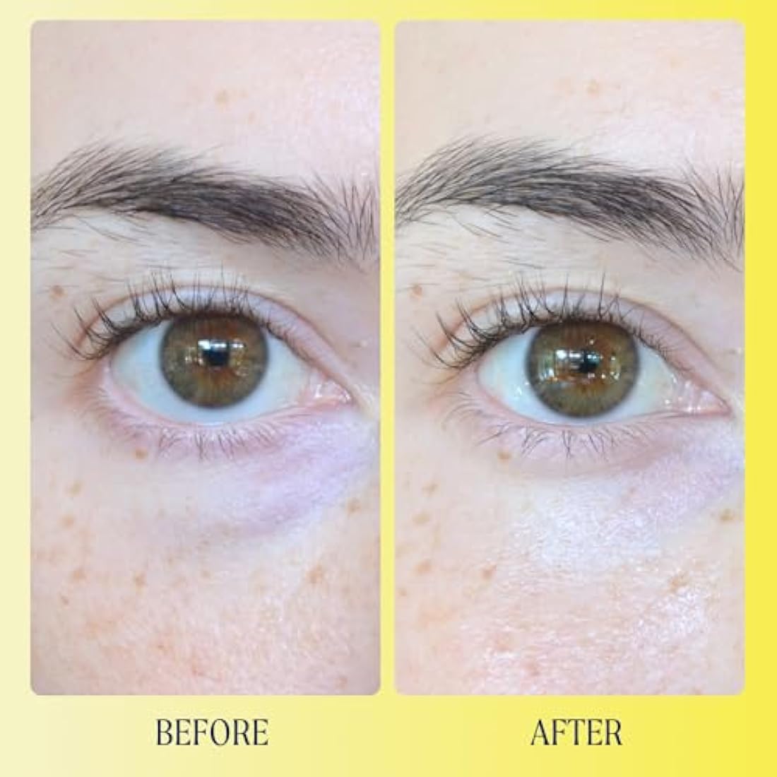 Kinship Brightwave Vitamin C Eye Cream – Energizing & Brightening 15ml