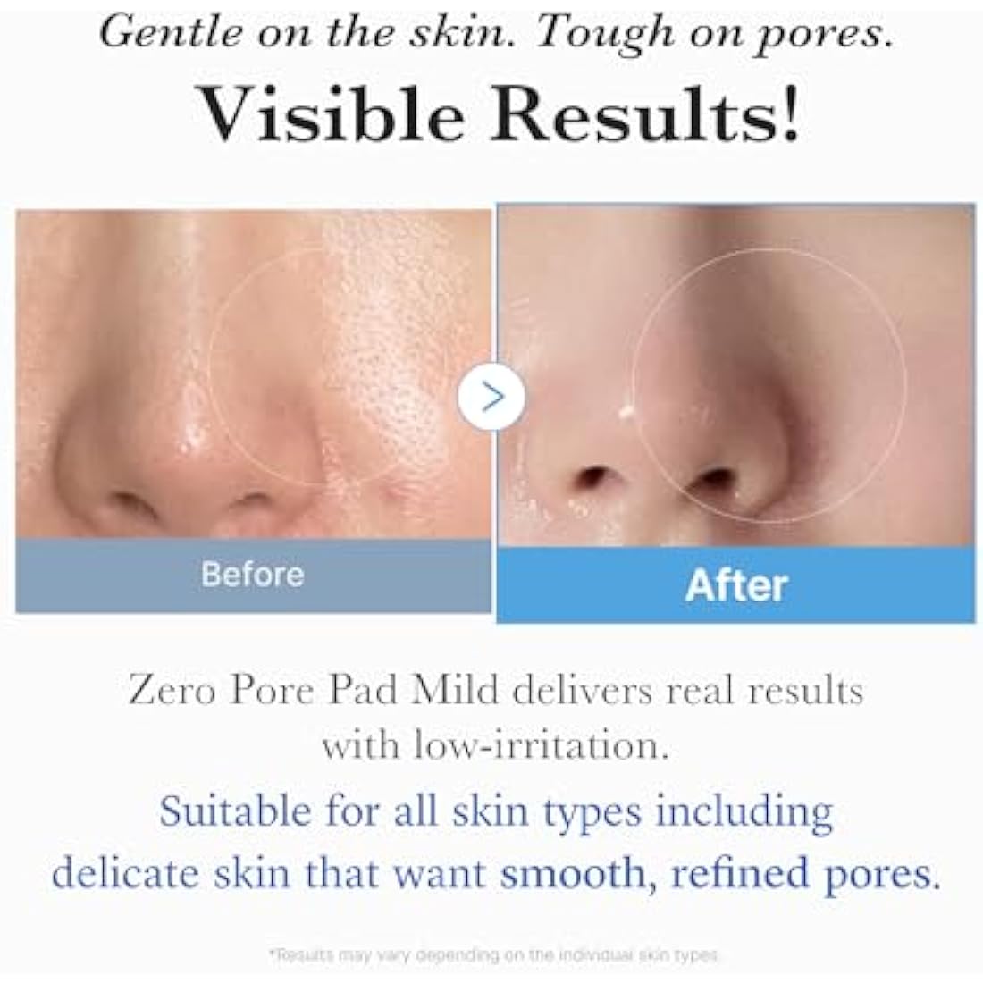 Medicube Zero Pore Pads Mild 2.0 – PHA Exfoliating Toner Pads (70ct)