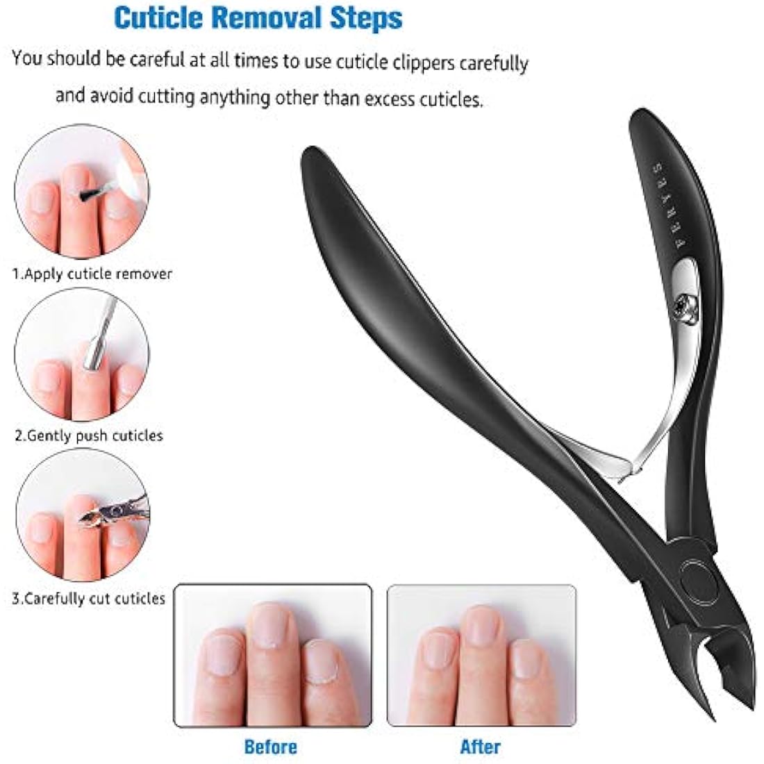 FERYES Professional Cuticle Nippers - Stainless Steel Dead Skin Remover