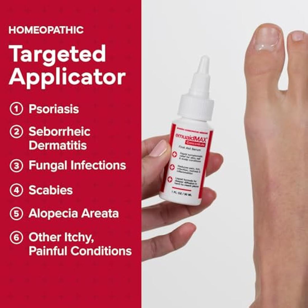 EMUAIDMAX First Aid Serum – Natural Eczema & Psoriasis Relief, 1 oz