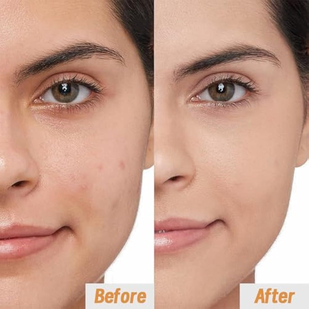 VGO Vitamin C Serum for Face | Anti-Aging with Hyaluronic Acid (60ml)