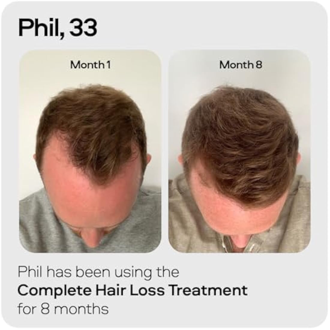 Sons Hair Growth Shampoo for Men | DHT Blocker & Thickening | 3 Pack