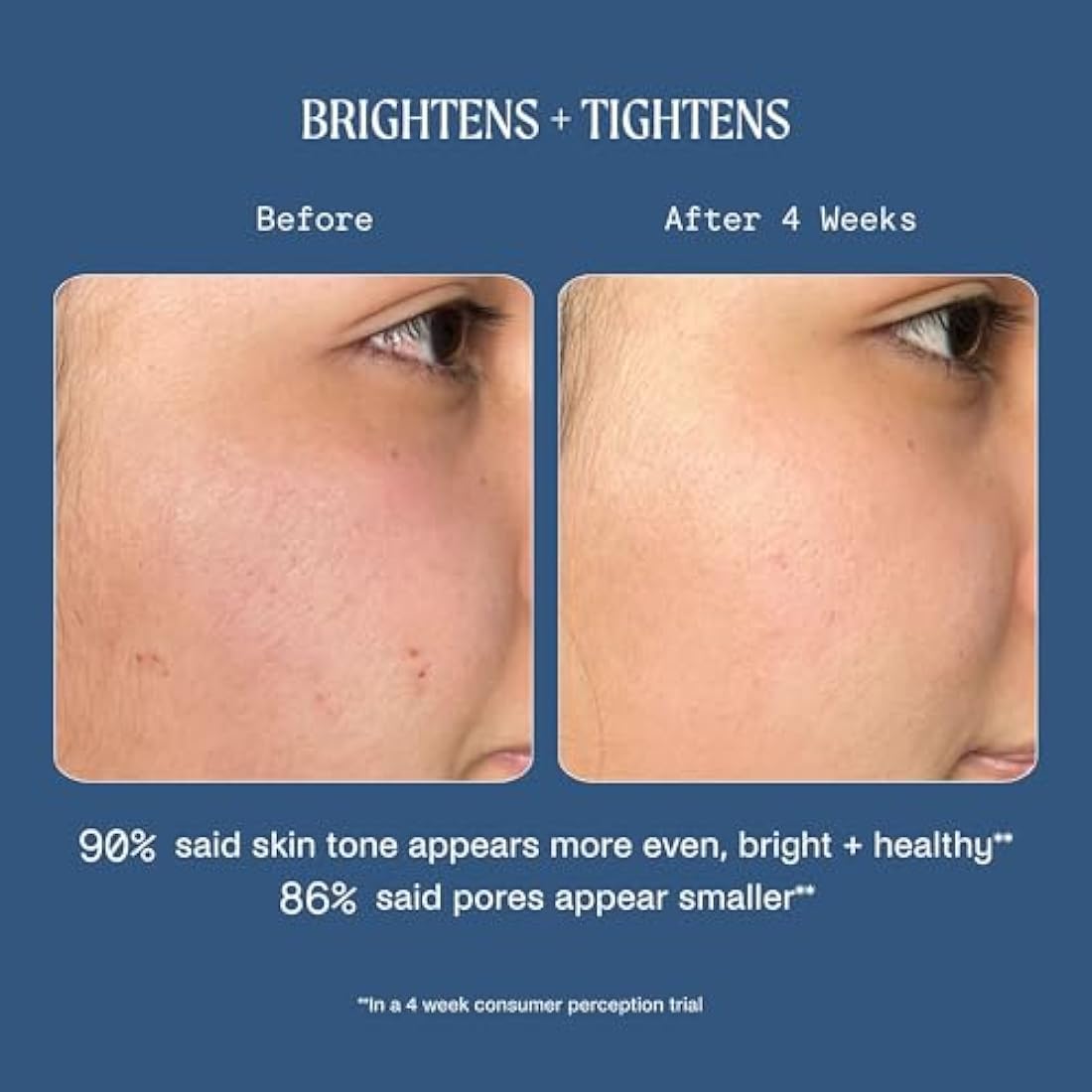 Kinship Dreamwave Bio-Retinoid Overnight Renewal Serum – 1 Oz