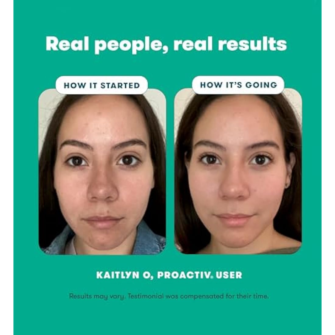 Proactiv Gentle 3-Step Routine | Sensitive Skin Blemish Control Kit