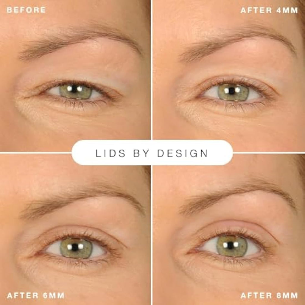 Contours Rx Lids by Design Eyelid Lift Strips for Hooded Eyes - 160 CT