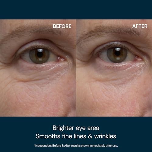 ELEMIS Pro-Collagen Eye Revive Mask – Anti-Aging & Hydrating Treatment