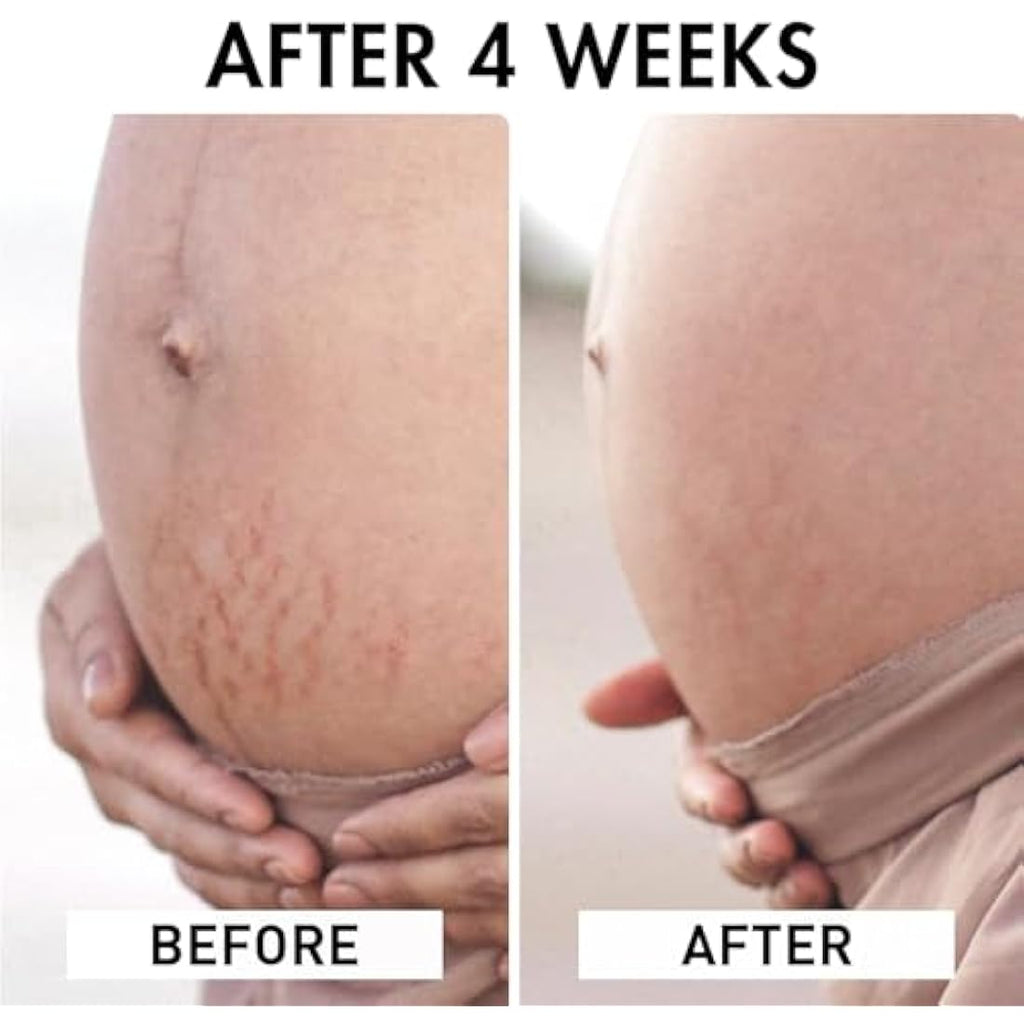 La Crème Libre Organic Stretch Mark Oil – 100% Natural Refillable 115ml