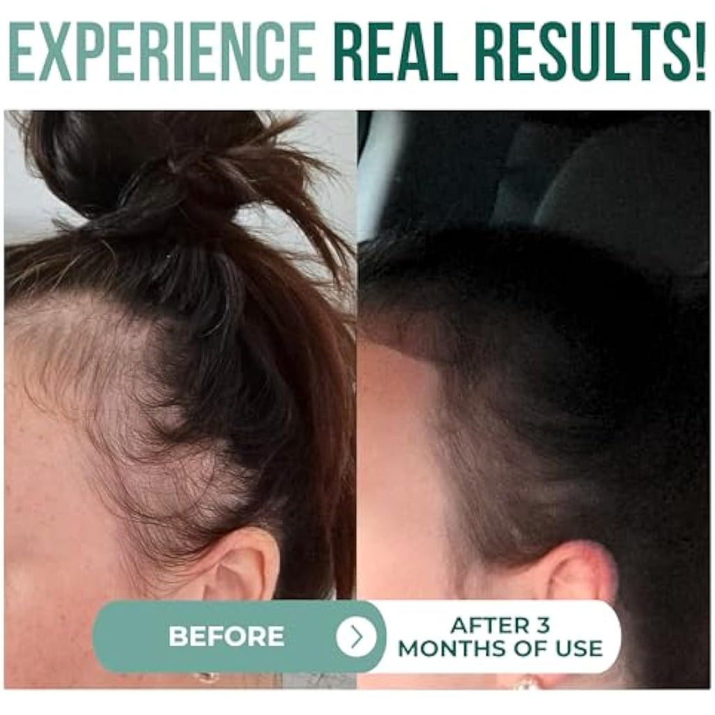 Jolof Store Organic Batana Oil – Cold Pressed Hair Growth Treatment