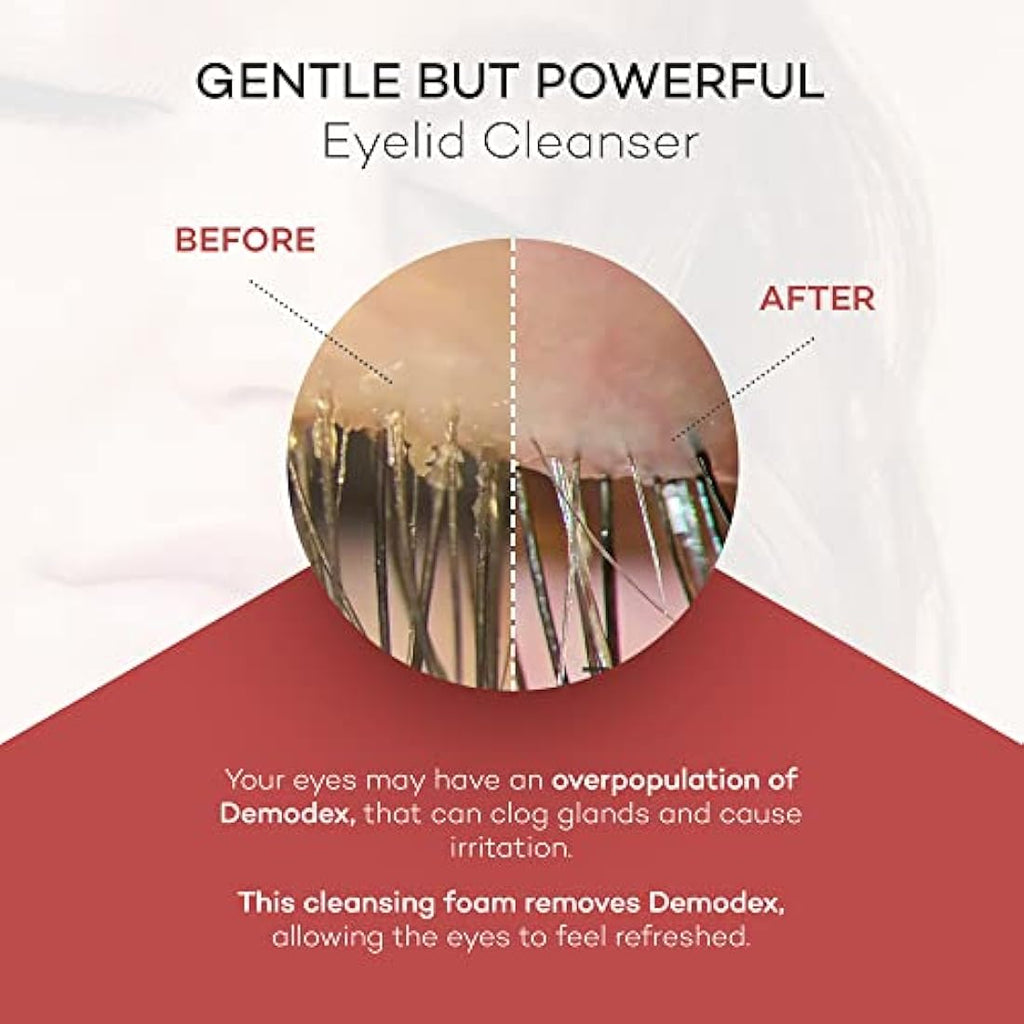 Zocular ZocuFoam Eyelid Cleanser – Okra-Based Foam for Dry Eyes, 50ml