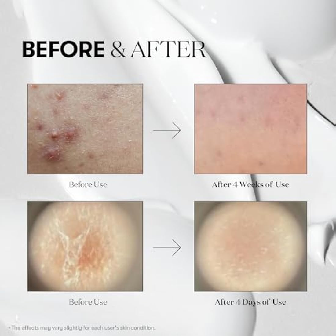 VT COSMETICS CICA Reedle Shot 700 - Microneedling Pore Serum (30ml)