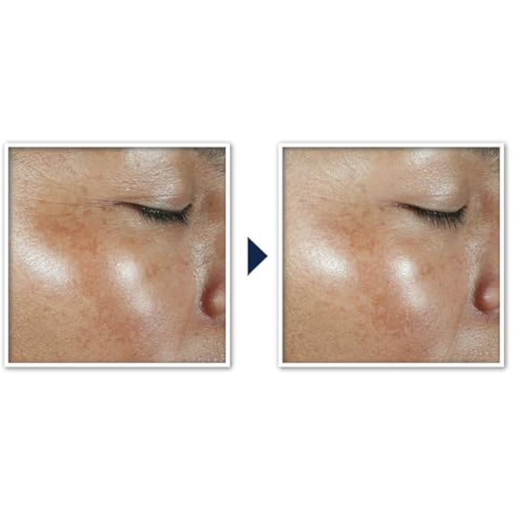 RoC Multi Correxion Revive + Glow Vitamin C Face Moisturiser SPF 30 - 50ml