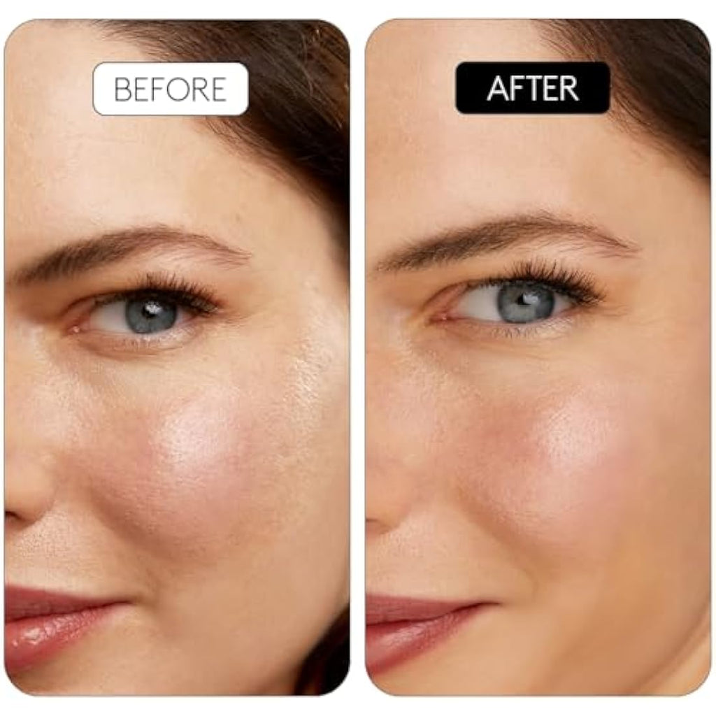 Cocunat Clinical Retinal 0.1 Serum - Anti-Aging Vitamin A with Niacinamide