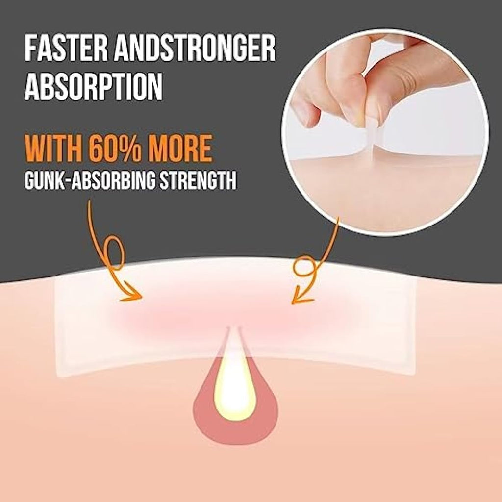 AUSLKA XL Hydrocolloid Pimple Patches – 20 Large Blemish Strips