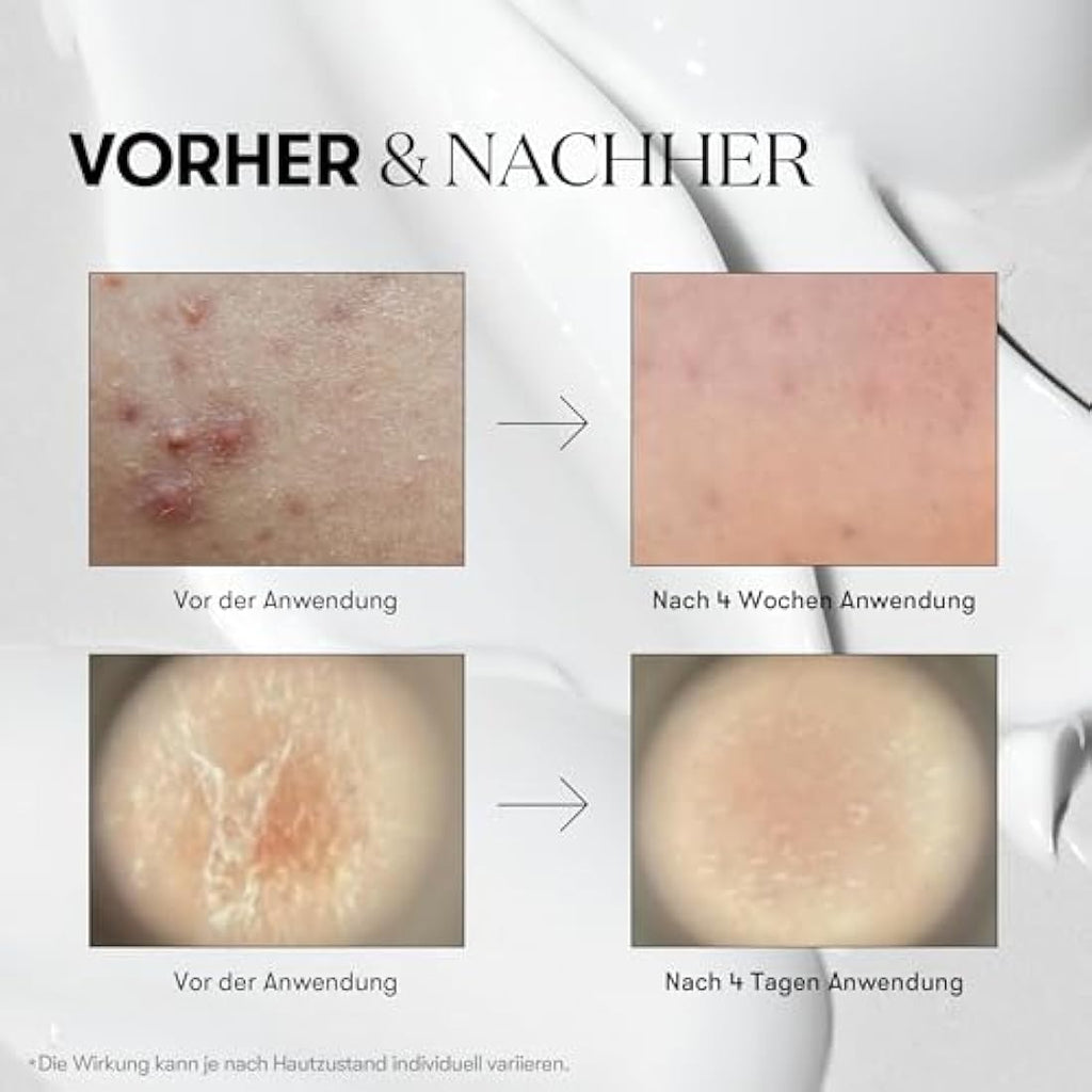VT COSMETICS CICA Reedle Shot 300 | Microneedling Pore Serum - 50ml