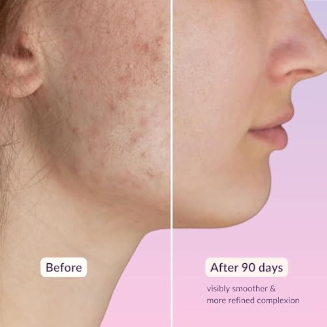 Retinol Serum 2.5% – Anti-Ageing with Hyaluronic Acid – 30ml