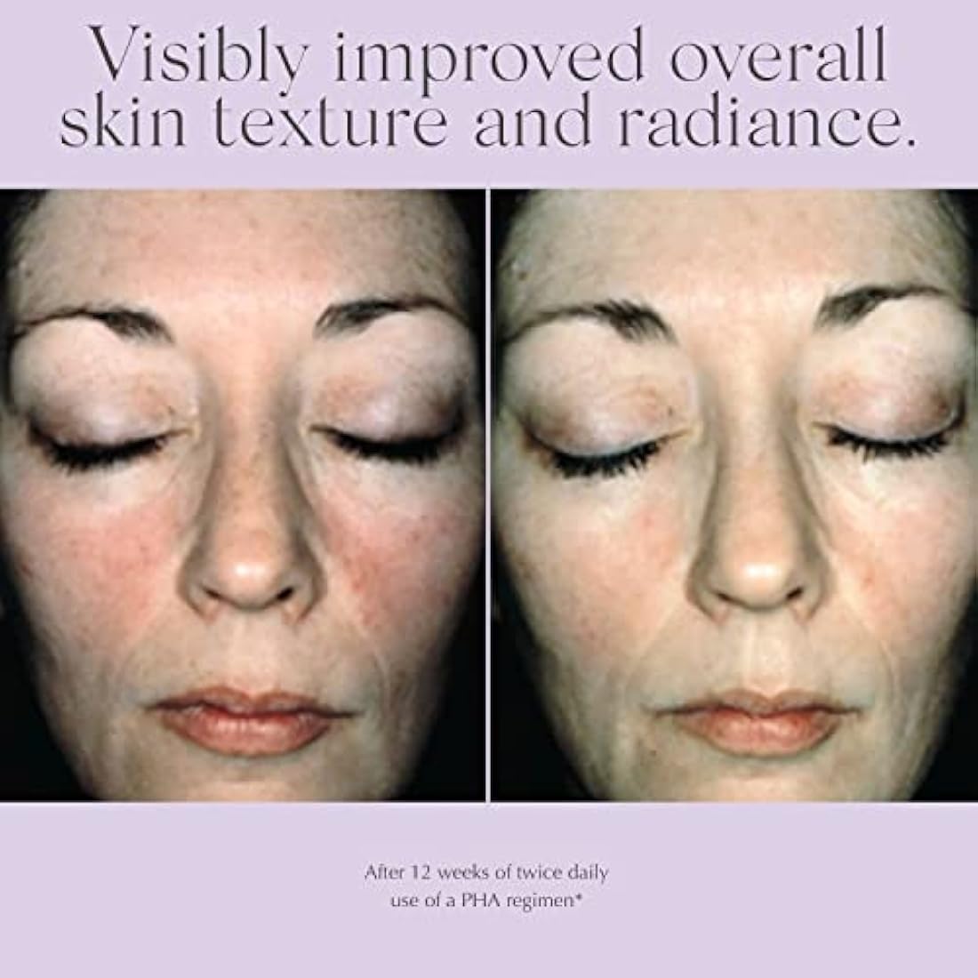 Exuviance Overnight Transformation Complex – Anti-Aging Night Cream