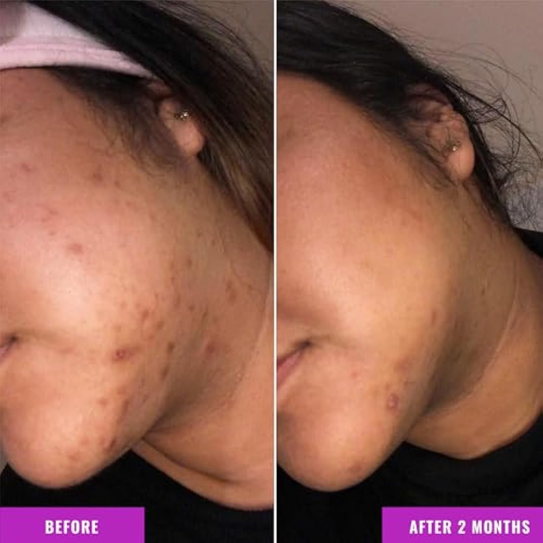 Good Molecules Discoloration Correcting Serum for Dark Spots - 75ml