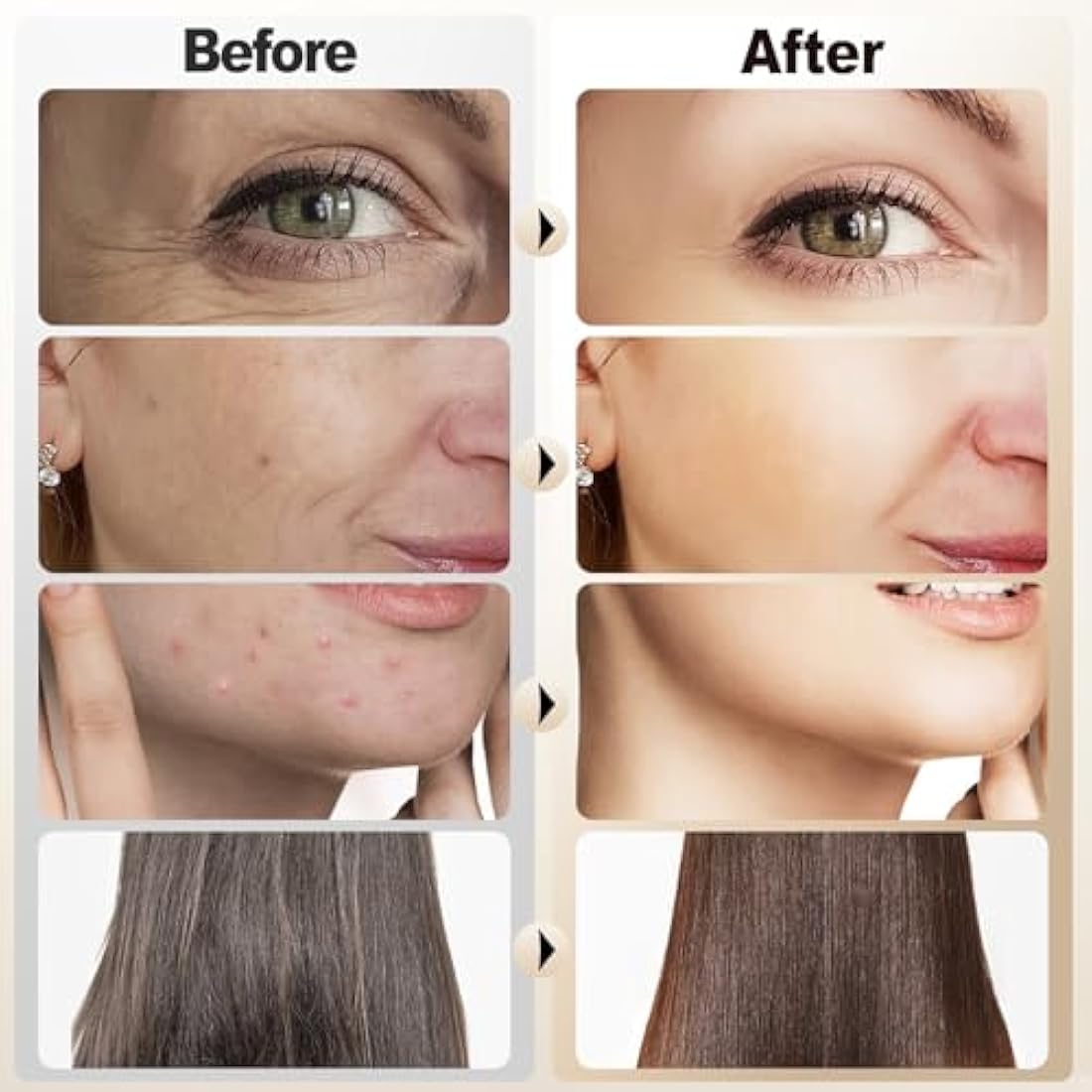 Blayram High Frequency Facial Wand – 4 Violet Tubes for Acne & Anti-Aging