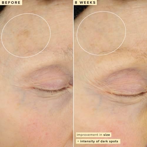 Farmacy 10% Vitamin C Face Serum – Waterless Dark Spot Remover (30ml)