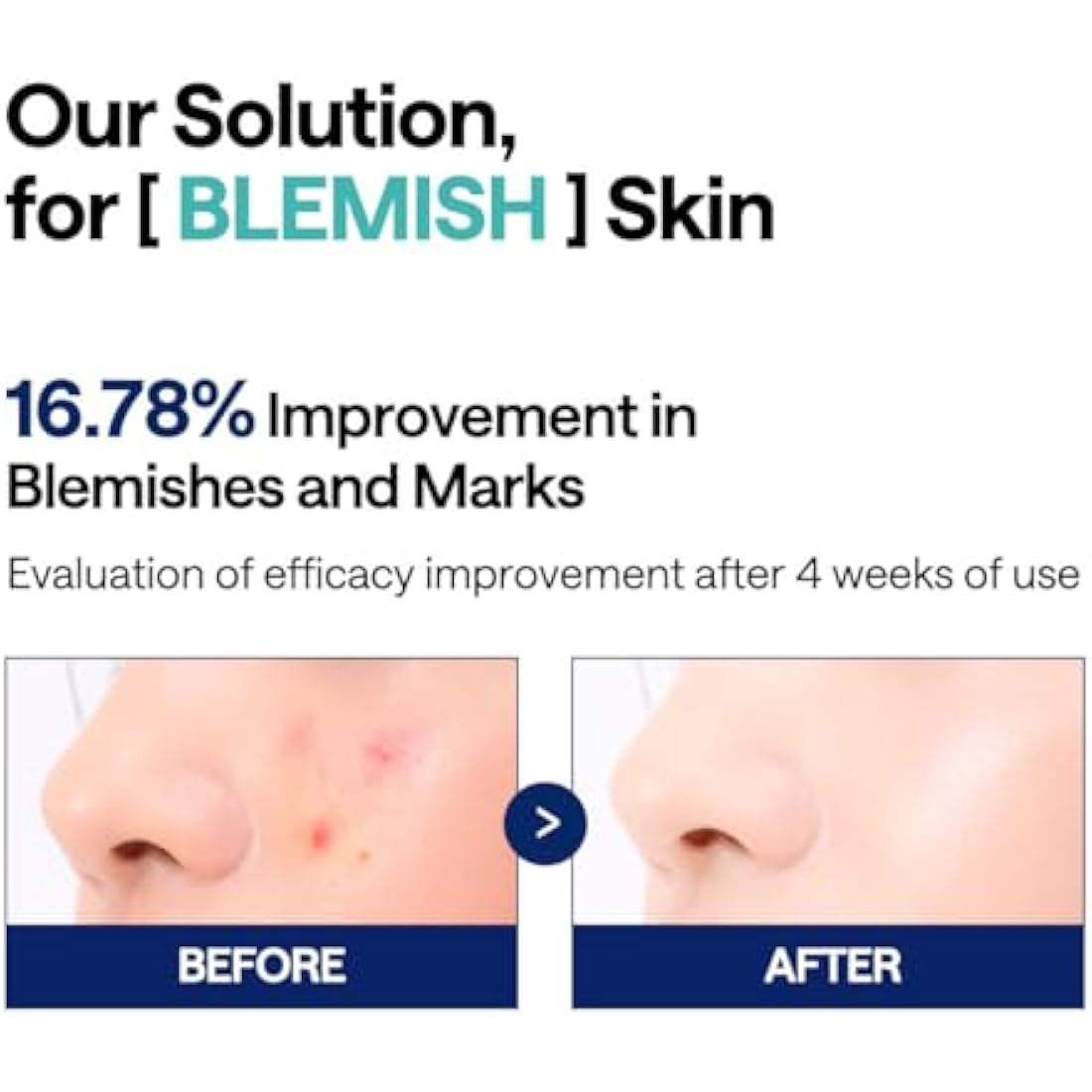 Mediheal Madecassoside Blemish Pads – Vegan Centella Toner Pads, 100ct