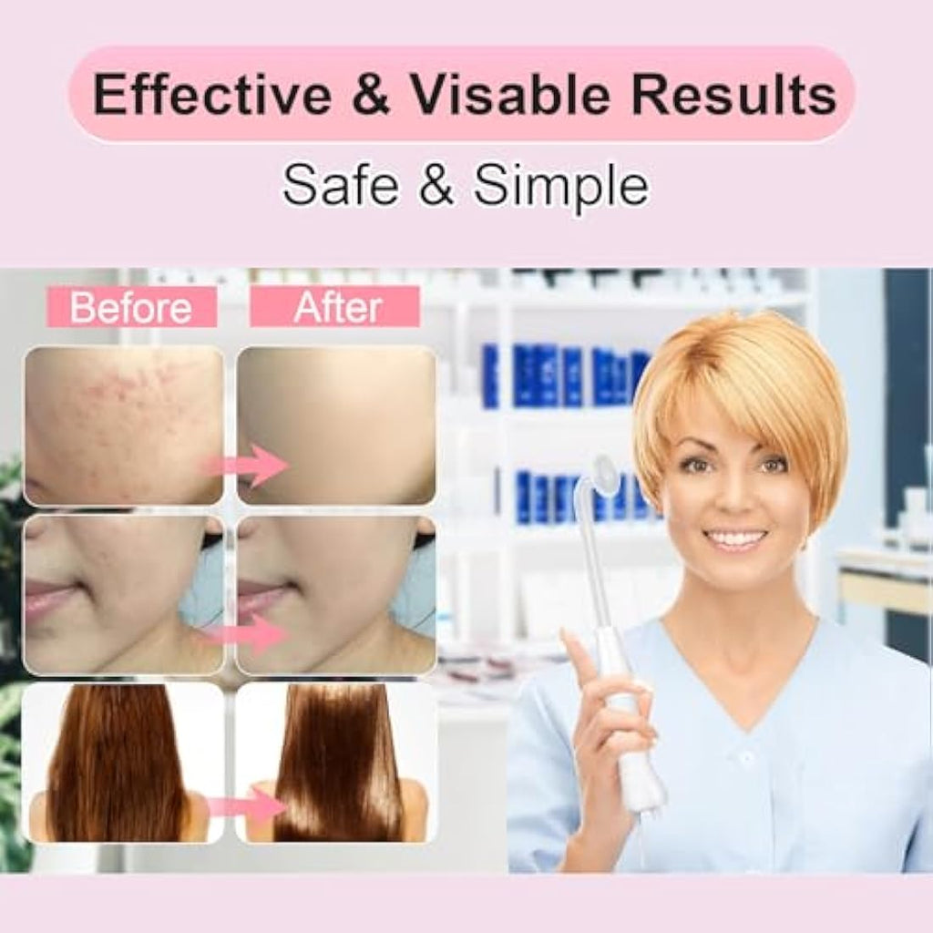 High Frequency Facial Wand – Portable Skin Tightening Machine