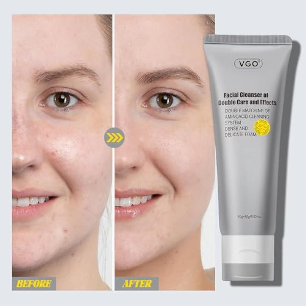 VGO Dual-Tube Amino Acid Face Cleanser | Pore Cleansing Mud Mask (100g)