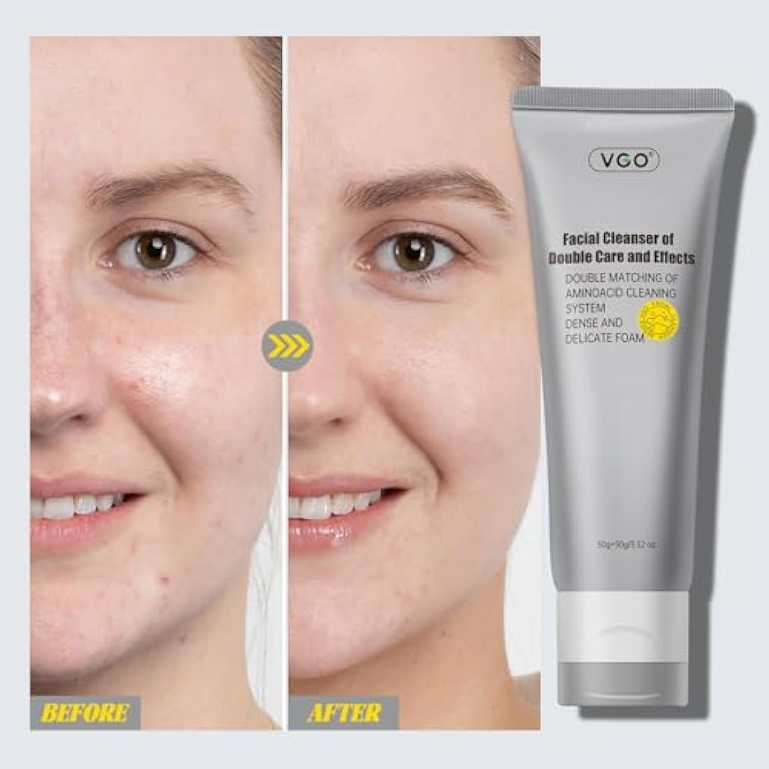 VGO Dual-Tube Amino Acid Face Cleanser | Pore Cleansing Mud Mask (100g)
