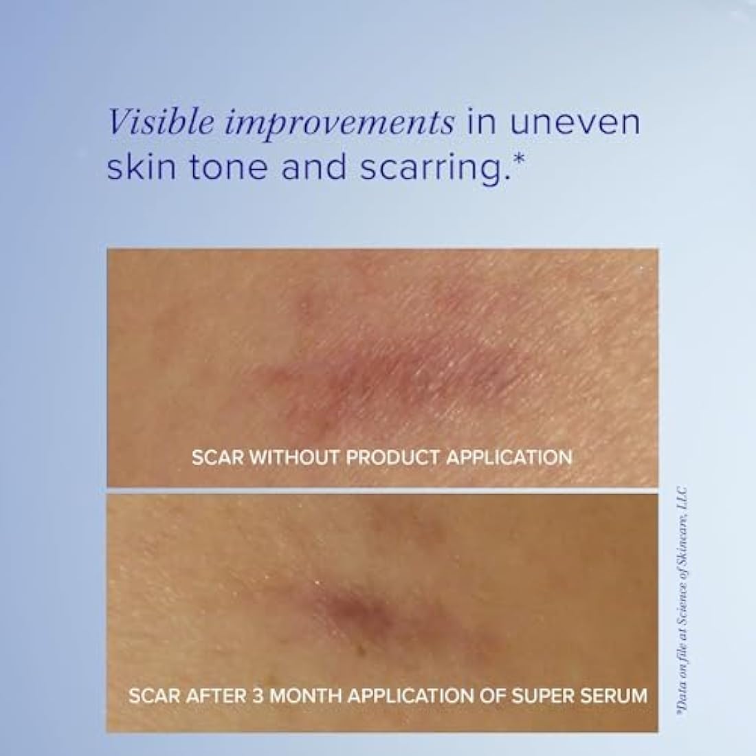 iS CLINICAL Super Serum Advance+ | Vitamin C Anti-Aging Face Serum