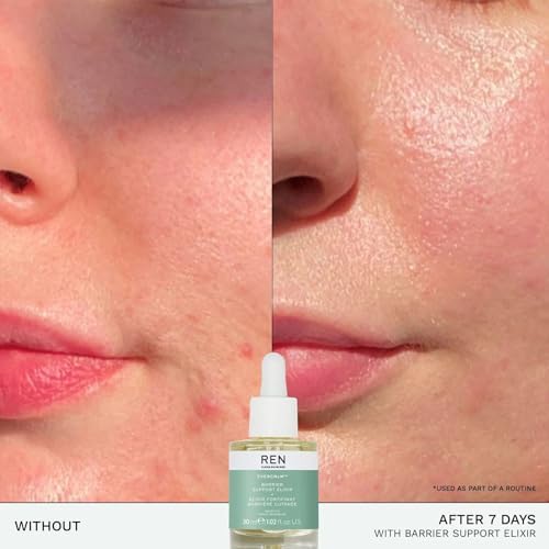 REN Evercalm Barrier Support Elixir – Hydrating Face Oil for Redness, 30ml