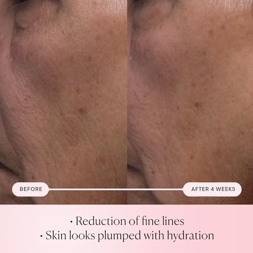 Elemis Pro-Collagen Anti-Aging Serum – Firming & Smoothing Treatment