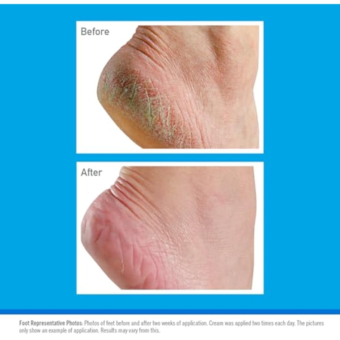O’Keeffe’s Healthy Feet Foot Cream for Cracked Heels, 91g Jar - 6 Pack